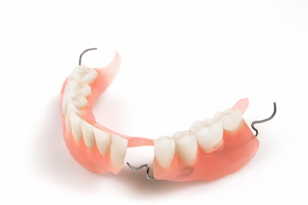 Simple partial prosthesis with wire brackets