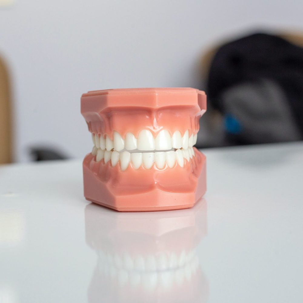 Complete Dentures